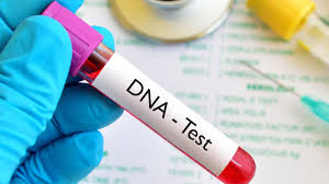 DNA Testing