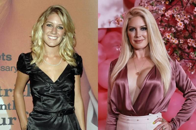 Heidi Montag Spent Over $1 Million